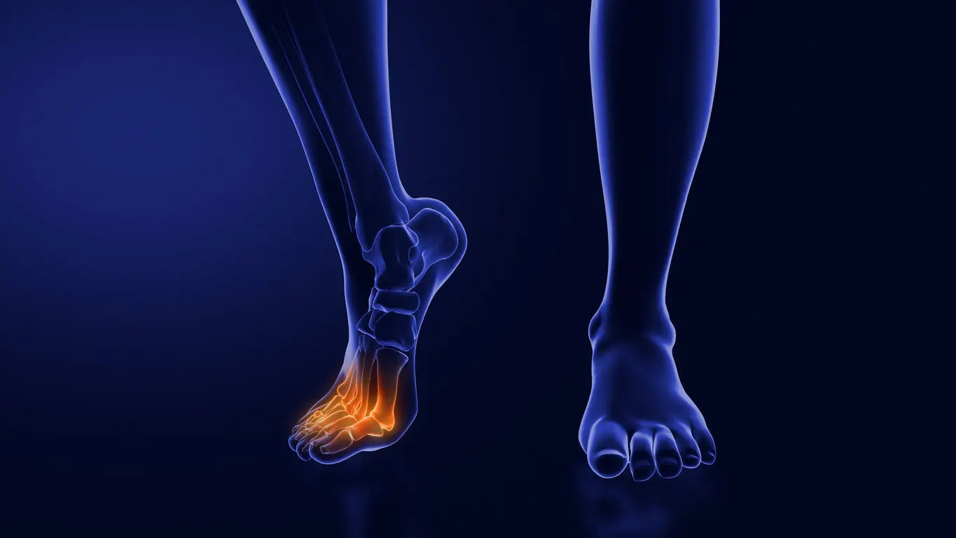 3D medical illustration of foot with highlighted forefoot bones showing pressure area, ideal for bunion pain and foot health education
