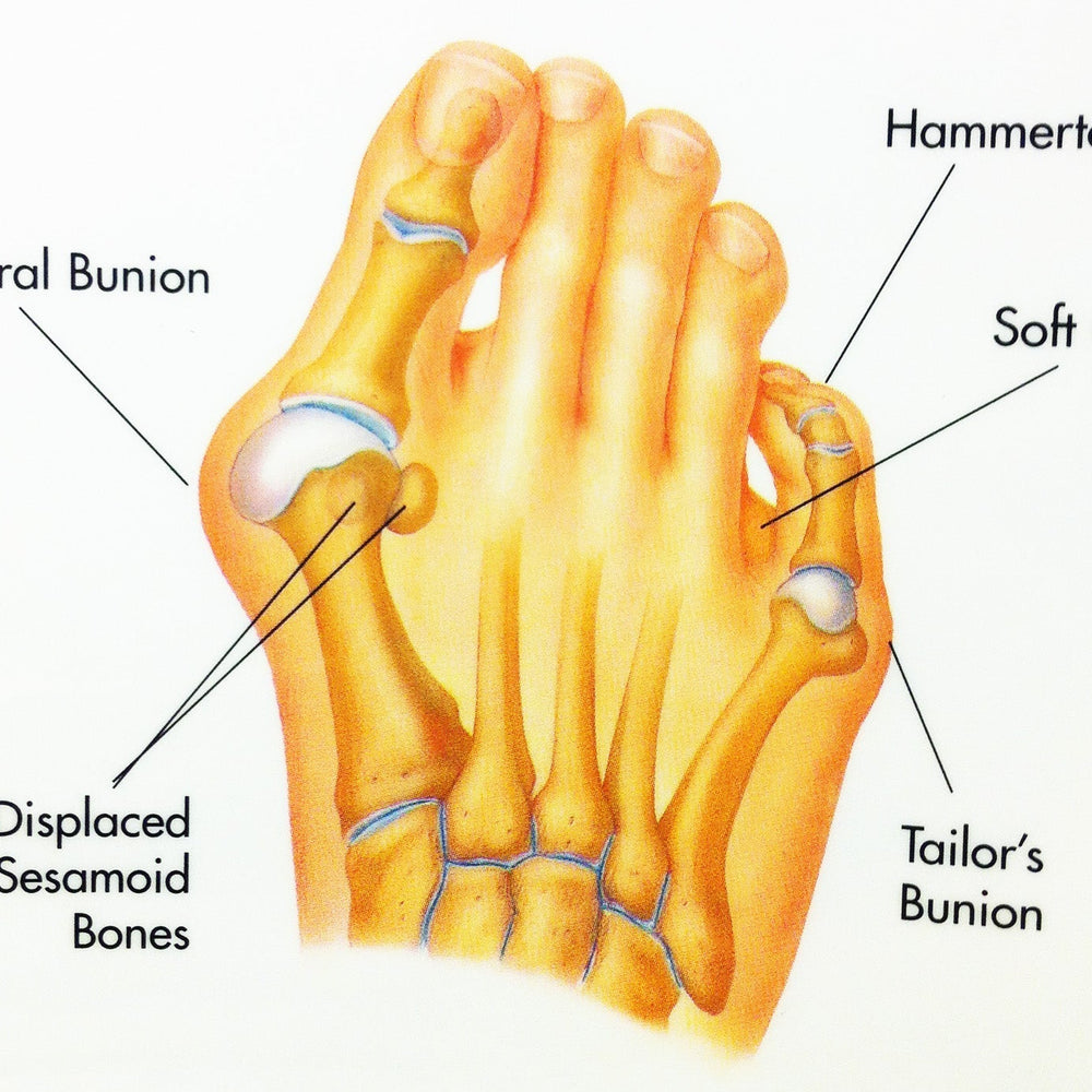 Top Solutions for Foot Pain Relief and Comfort